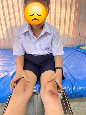 นครนายก คลิปเป็นข่าว ผู้ปกครองนักเรียนฝากเตือนช่วงโรงเรียนเลิกเรียนในซอยหน้าโรงพักกรุณาขับรถช้าๆหน่อยเฉี่ยวชนเด็กล้มได้รับบาดเจ็บไม่มาดู