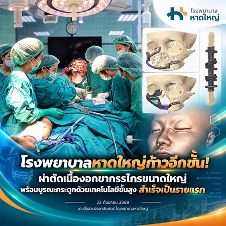 สงขลา-โรงพยาบาลหาดใหญ่ก้าวอีกขั้น ผ่าตัดเนื้องอกขากรรไกรขนาดใหญ่ พร้อมบูรณะกระดูกด้วยเทคโนโลยีขั้นสูง สำเร็จเป็นรายแรกของโรงพยาบาล